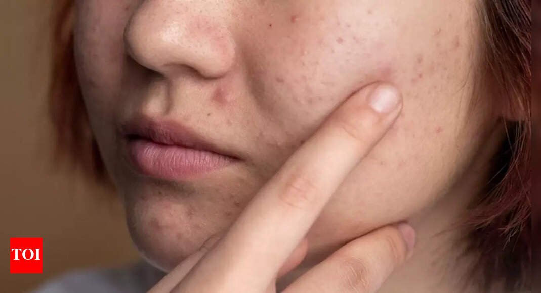 4-ways-fatty-liver-disease-can-show-up-on-your-face