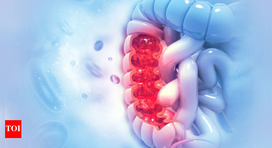 colon-cancer-on-the-rise-among-youngsters:-5-warning-symptoms-that-should-not-be-ignored