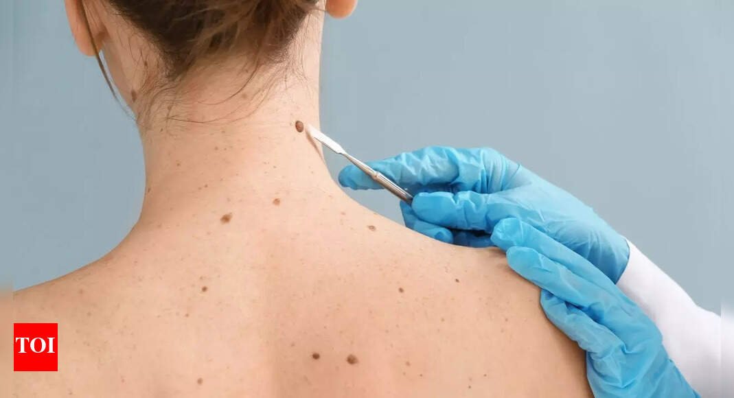 7-early-symptoms-of-cancer-that-often-get-dismissed-as-minor-illnesses
