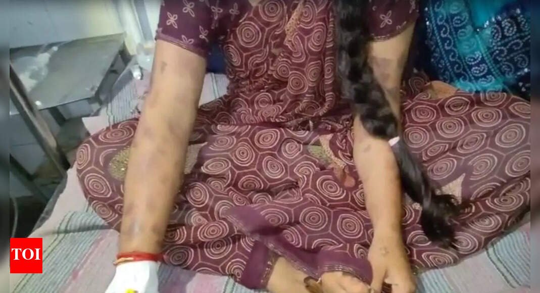 ‘not-beautiful-enough’:-mp-bride-tortured,-branded-with-hot-knife;-over-50-burn-marks-found