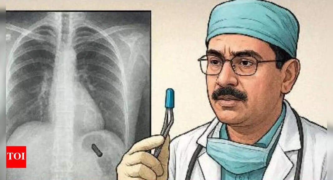 pen-cap-stuck-in-lung-for-26-yrs:-delhi-doctors-remove-object;-express-shock