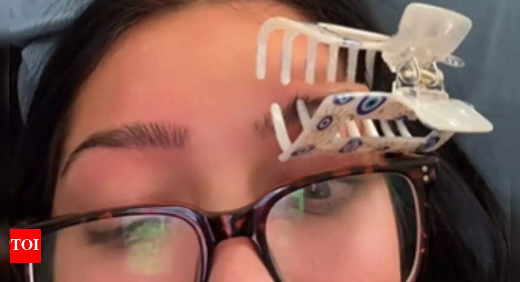 fact-check:-does-putting-a-claw-clip-on-the-eyebrow-really-help-with-migraines?