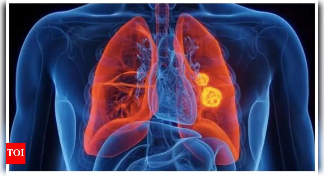 lung-cancer-rising-in-young-adults-–-causes,-symptoms,-and-prevention
