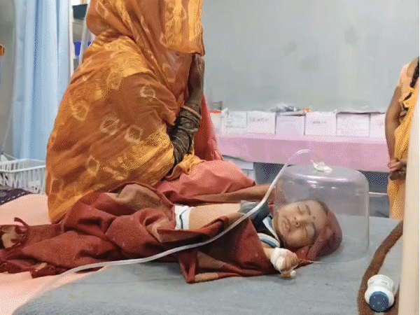 children-with-pneumonia-branded-with-hot-rods-in-jhabua:health-remains-critical;-family-members-used-sticks-on-tantric’s advice;-investigation-underway
