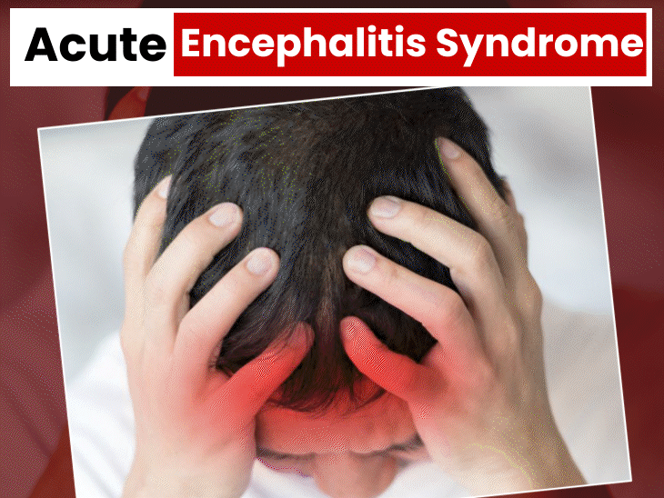 14-children-die-of-suspected-‘acute-encephalitis-syndrome’:doctor-explains-the-causes-of-this-disease-and-which-group-is-at-great-risk-of-getting-infected