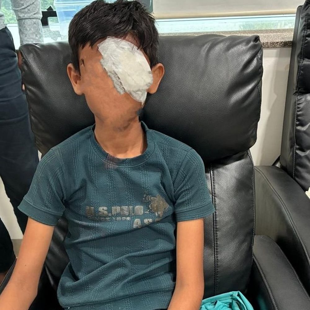 12-year-old-boy-injured-making-firecracker-inspired-by-youtube-video:18-eye-injuries-reported-post-diwali;-eight-undergo-emergency-surgeries-in-indore-hospitals