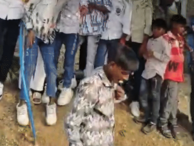 youth-severely-injured-as-firecracker-explodes-in-mouth:seven-bombs-burst-earlier-in-jhabua;-8th-exploded-while-following-social-media-trend