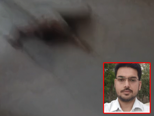 mp-radiotherapist-dies-by-suicide-in-faridabad:wife-called-police-over-a-dispute,-and-during-the-conversation,-he-jumped-from-15th-floor