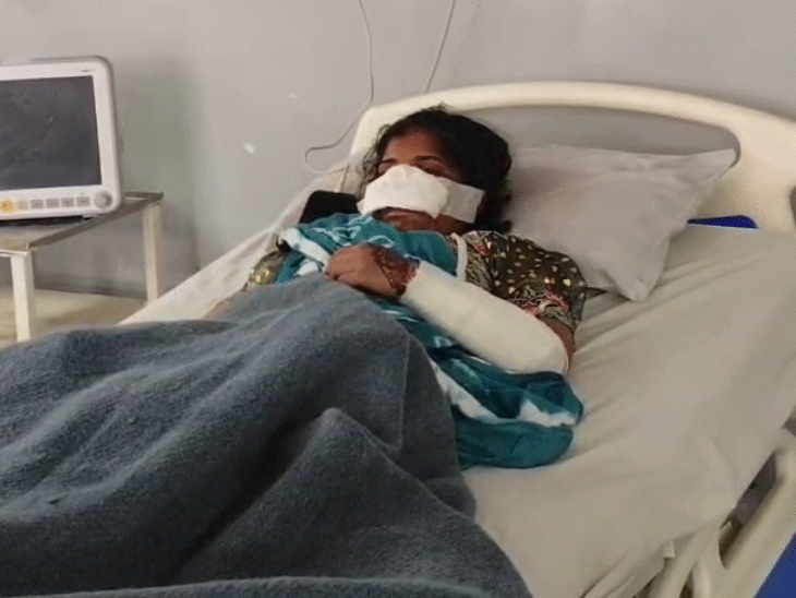 husband-cuts-off-wife’s-nose-in-jhabua:beats-her-with-stick-for-talking-to-another-man,-later-takes-her-to-hospital-himself-in-panic