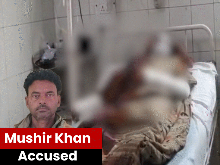brother-in-law-throws-acid-on-widowed-sister-in-law:accused-wants-to-marry-her,-attacks-the-victim-when-she-refuses;-gwalior-police-arrest-him
