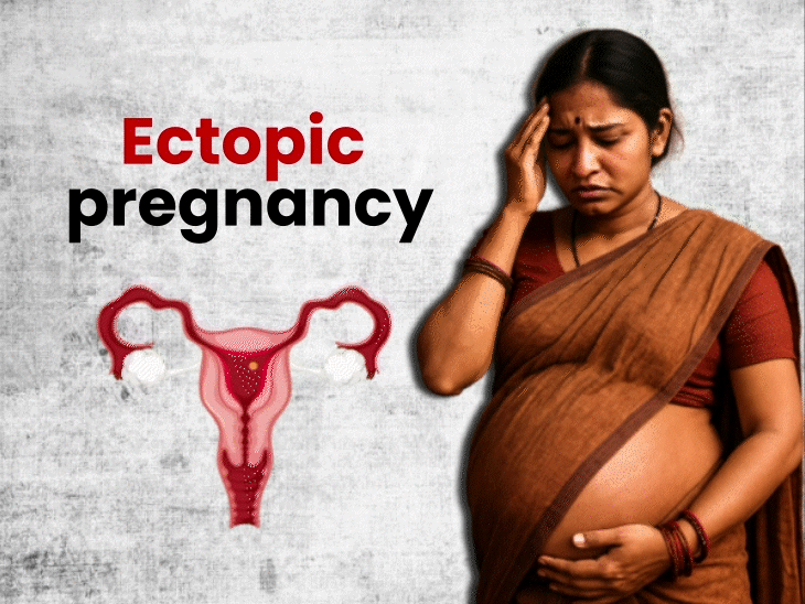 ectopic-pregnancy-poses-deadly-risk-for-women:baby-grows-in-fallopian-tube,-not-womb;-bhopal-model-died-from-same-cause,-smokers-at-higher-risk