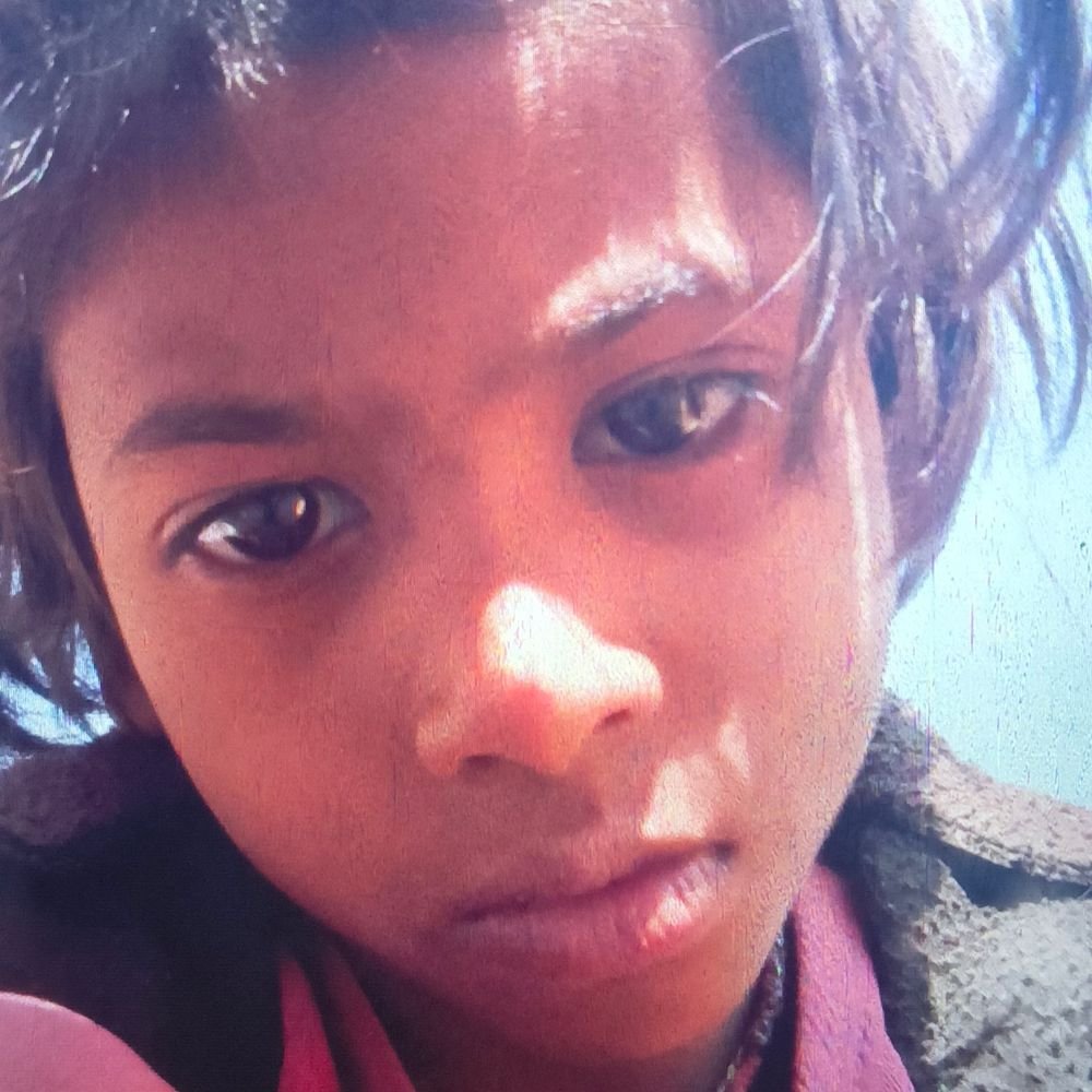 wild-boar-attack-claims-life-of-7-year-old-girl-in-vidisha:mauled-while-playing-outside-home;-succumbs-to-injuries