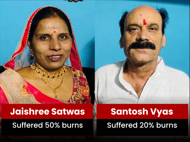 couple-attempts-self-immolation-in-dewas,-wife-critically-burnt:husband-with-20%-burns-stable-after-treatment;-burn-expert-explains-severity