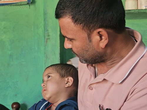 five-year-old-asks,-‘will-i-be-able-to-play-again?’:child-survives-poisonous-cough-syrup-after-battle-of-115-days-between-life-and-death