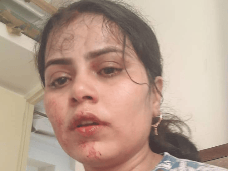 satna-businessman-attempts-to-kill-his-wife:makes-her-drink-phenyl-for-a-₹35-lakh-loan,-says-her-death-would-clear-debt-amount