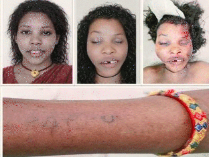 ai-reconstructs-deceased-woman’s-identity-in-gwalior-murder-case:omelette-piece-on-victim’s-sweater-becomes-key-clue;-lover-arrested-for-rape,-killing