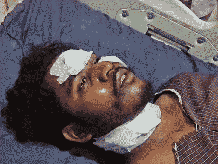 youth’s-throat-slashed-by-chinese-manja-in-chhindwara:string-lying-on-road-causes-bike-accident;-shoulder-bone-and-ribs-fractured,-14-stitches-required