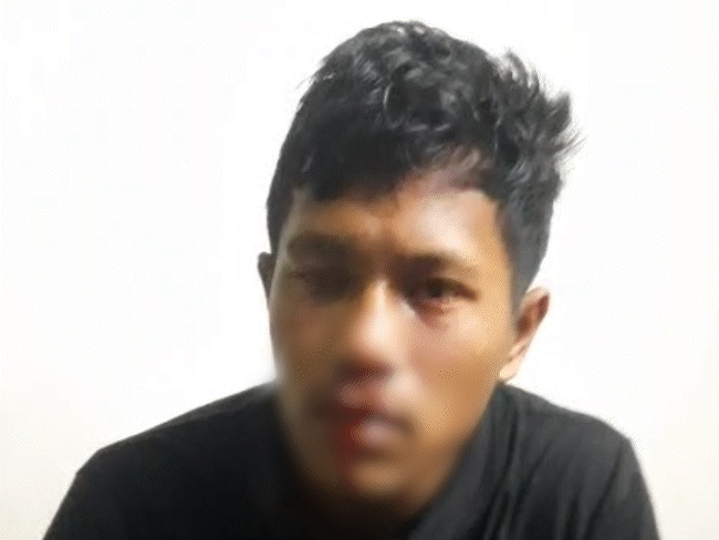 assam-student-beaten-in-mp’s-indira-gandhi-national-tribal-university:nose-fractured;-fears-for-life-after-attackers-enter-hostel-and-assault-him