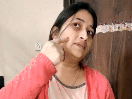 model’s-face-ruined-in-gwalior-parlor:excess-chemical-mixed-in-wax,-leaves-wounds-and-spots;-court-orders-penalty-on-salon-owner