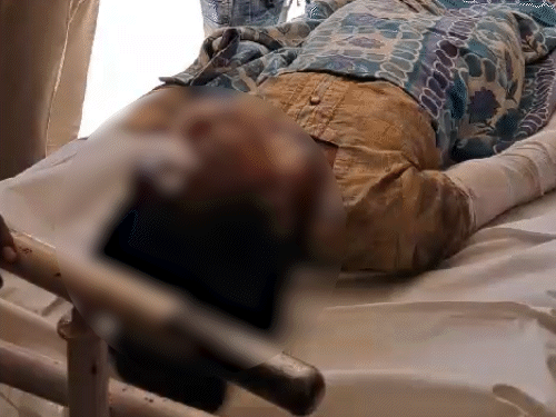 father-son-get-life-term-for-women-murder:burned-young-lady-alive-with-petrol-in-khandwa-to-avenge-her-molestation-complaint-police-report