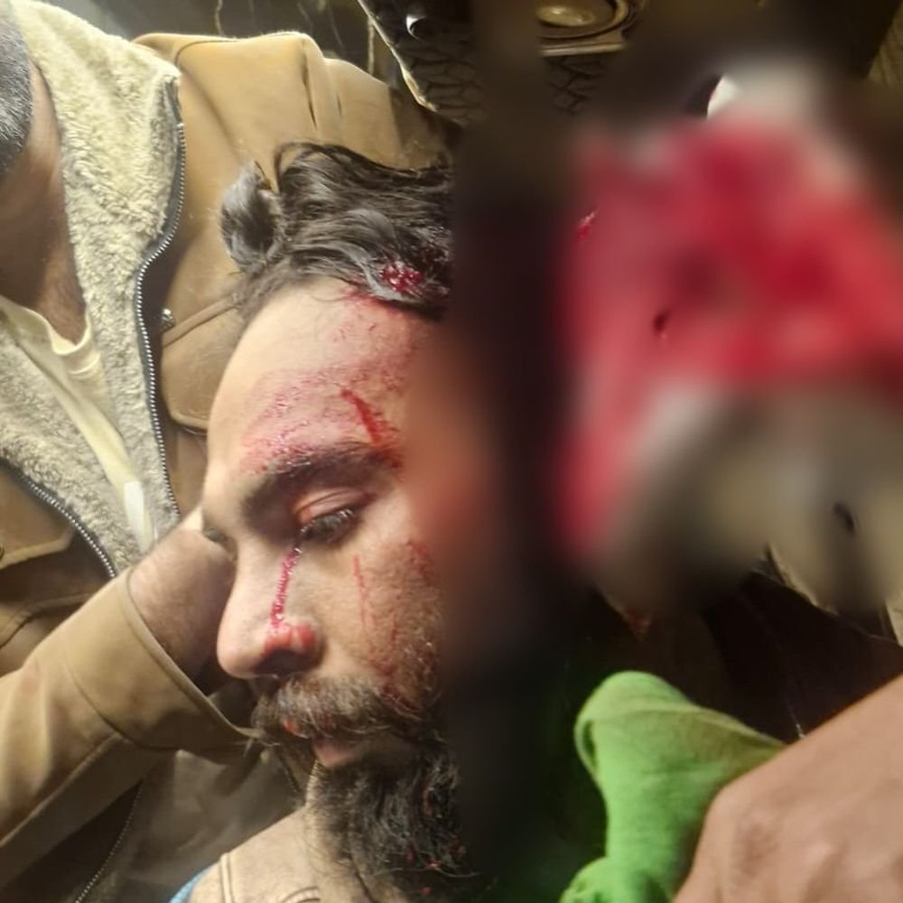 indore-software-engineer-assaulted-in-pachmarhi:accused-adventure-tour-operator-attacked-him,-after-he-complained-about-poor-food-and-service