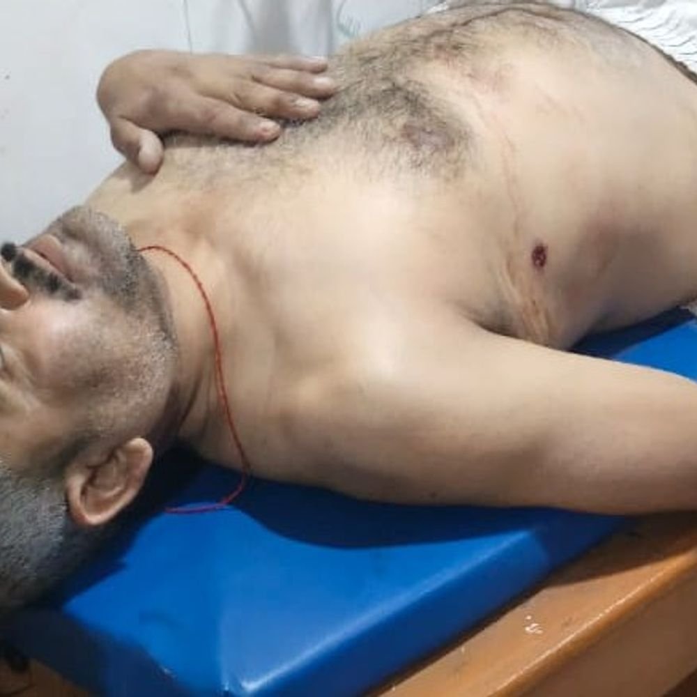 retired-soldier-opens-fire-on-cement-trader-in-morena:calls-him-by-name-to-unlock-door,-bullet-rips-through-victim’s-ribcage;-accused-on-the-run