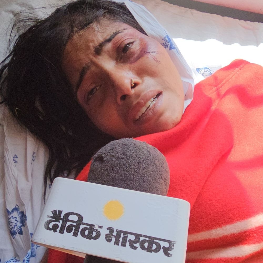 husband-tries-to-hang-wife,-then-sets-her-on-fire:woman-survives,-walks-4km-to-police-station;-asks-police-not-to-file-fir