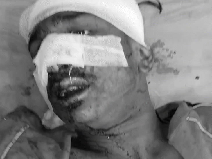 masked-gang-brutally-attacks-2-men-in-bhopal:stabbed-and-beaten-unconscious-in-brutal-38-second-revenge-attack