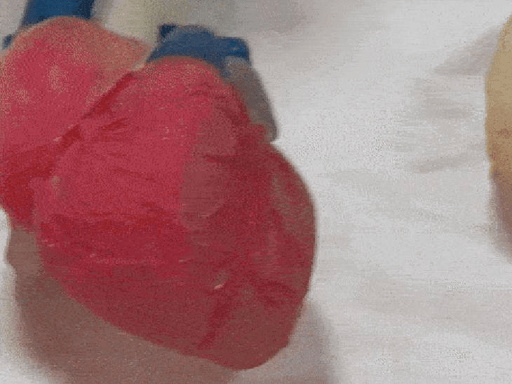 vitamin-d-and-b12-deficiency-increase-risk-of-heart-attack:8-out-of-10-patients-in-bhopal-show-insufficiency