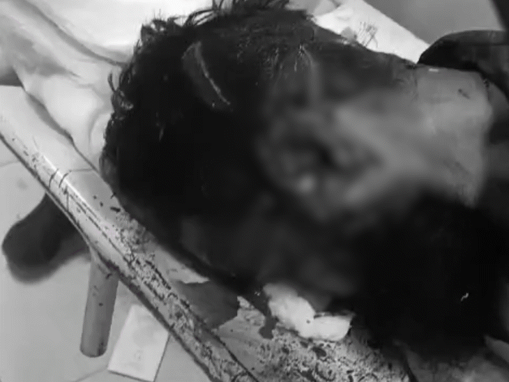 youth’s-ear-severed-in-knife-attack-in-bhopal:miscreants-stab-head,-neck-repeatedly-after-he-refuses-to-settle-old-case