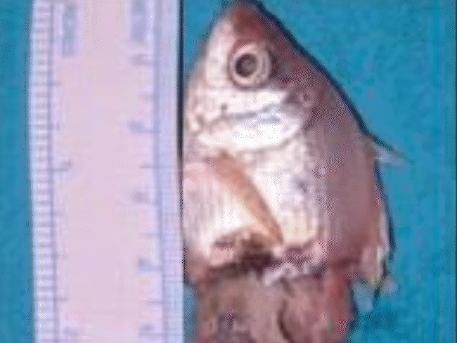 fish-stuck-in-throat-of-1-year-old-child:swallowed-while-playing-in-indore;-doctors-removed-3-inch-fish-through-operation