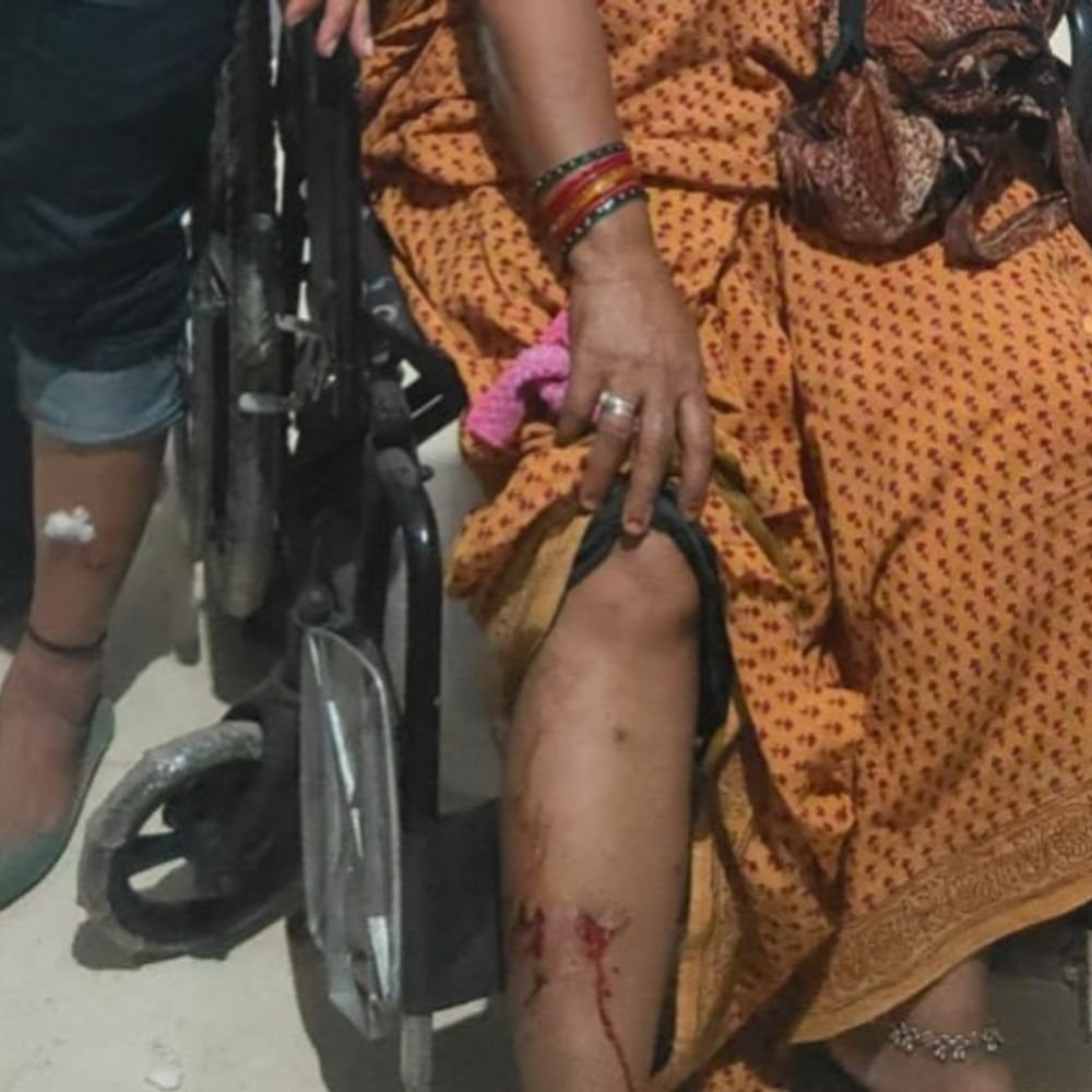 stray-dog-bites-40-passers-by-within-3-hours-in-satna:rush-at-hospitals-for-anti-rabies-injections;-panic-in-manawar-market