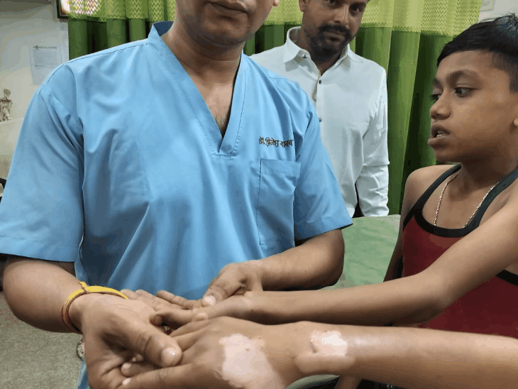 10-year-old-boy’s-smartwatch-explodes:twin-brother-also-burnt,-watch-bursts-during-wedding-function;-skin-peels-off-hand