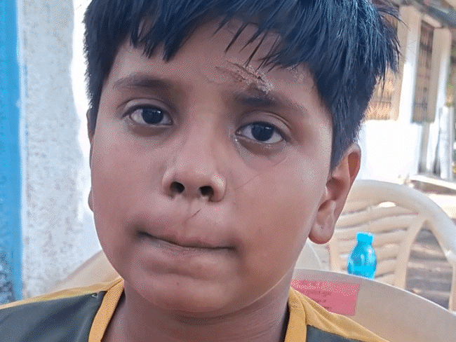 tamil-nadu-family-loses-5-in-jabalpur-tragedy:mother,-father,-brother-dead;-10-year-old-survives-with-help-of-rope