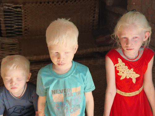 four-children-battling-rare-disease-seek-government-support:family-say-poverty-and-biometric-failures-blocking-ration-and-disability-benefits