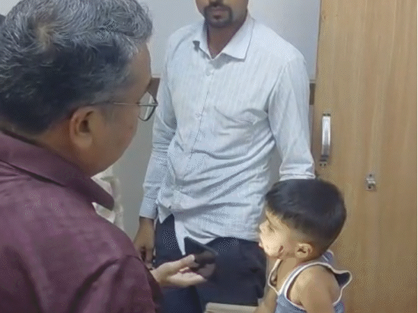 3-year-old-injured-by-stray-dog-in-pandhurna:seven-bite-marks-found-as-child-recalls-frightening-encounter