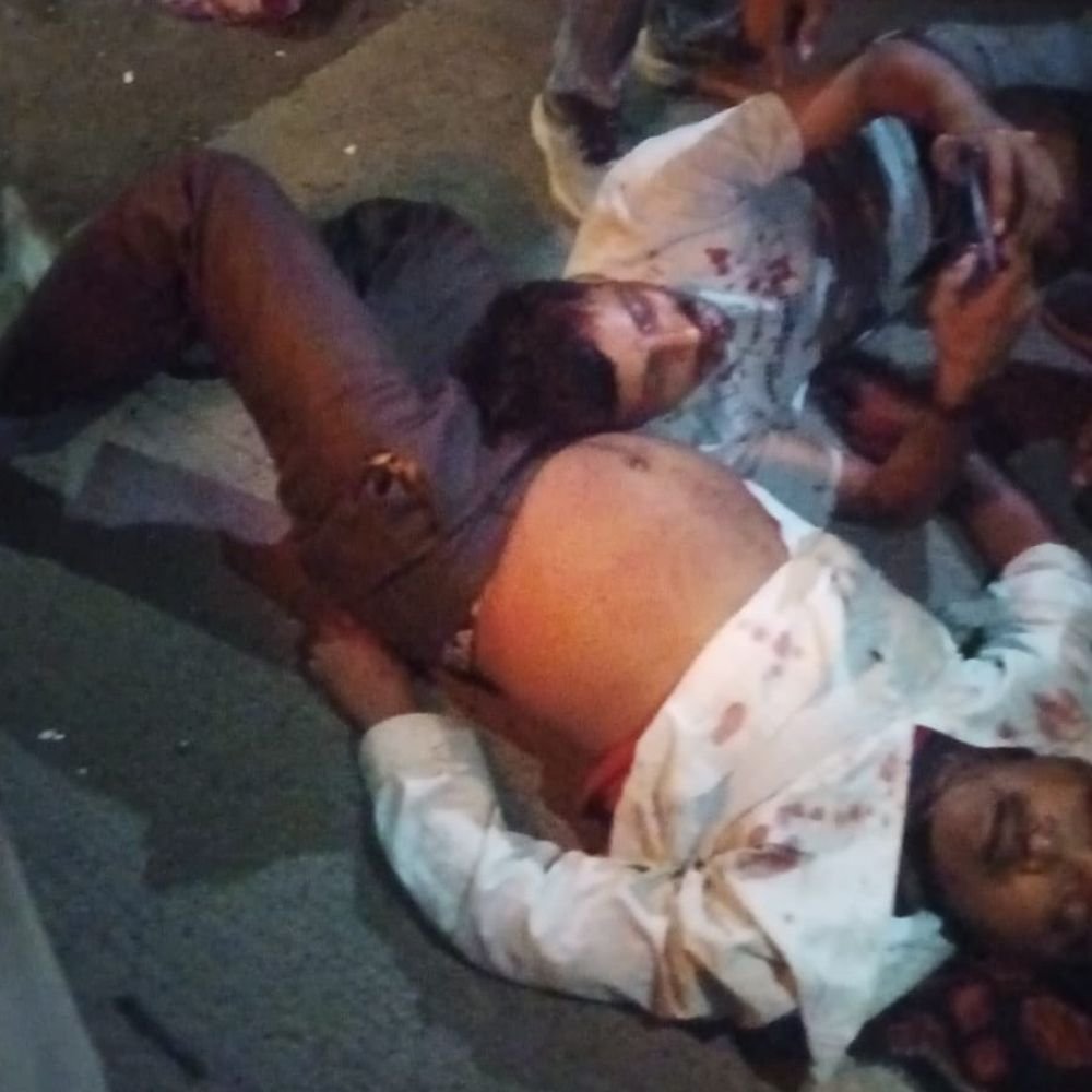 1-dead-as-workers’-bus-collides-with-truck-in-shajapur:18-people-suffer-injuries-in-nh-52-accident;-vehicle-heads-to-lalitpur