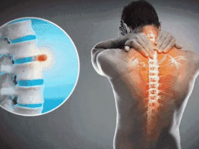poor-posture-triggers-silent-slip-disc-crisis:4-5-patients-reach-paralysis-stage-every-day;-bad-posture-is-also-a-reason