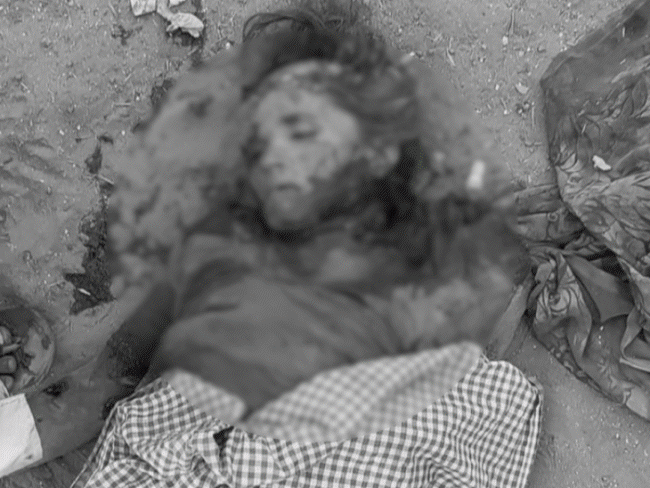 woman-mauled-to-death-by-stray-dogs-in-barwani:doctor-reveals-severe-mutilation;-800-dog-bite-cases-this-year
