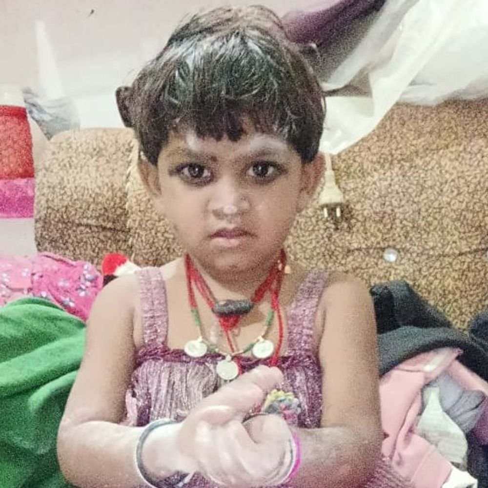 house-collapsed-after-explosion,-4-year-old-child-dies:4-family-members-seriously-burnt;-referred-from-shivpuri-to-gwalior