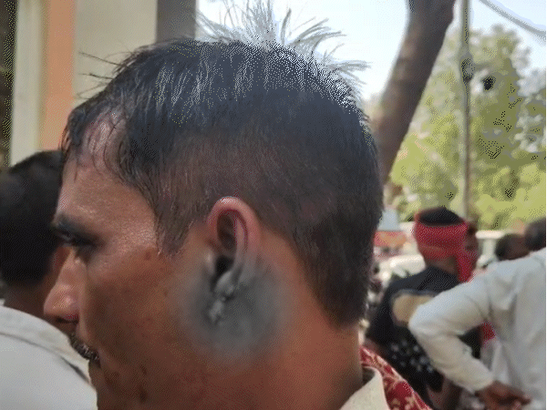 flour-mill-owner-bites-customer’s-ear:attack-in-bhind-over-a-dispute-of-just-₹5