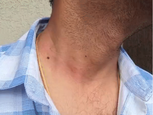 businessman-assaulted-over-land-dispute:claims-attackers-pointed-revolver-before-assault,-8-booked-including-bjp-leader